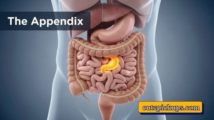 The Appendix Do